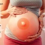 Várandós nő hasán lévő figyelmeztető jelzés a székrekedésről.